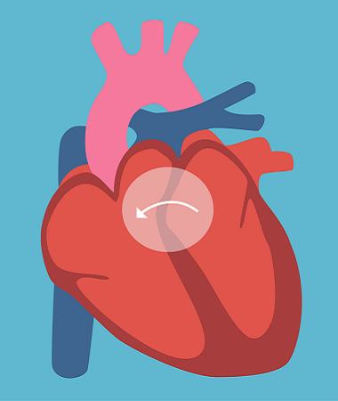 Cardiac Disease Treatment